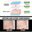 Bamboo Charcoal Facial Mask for Blackhead Removal and Pore Control