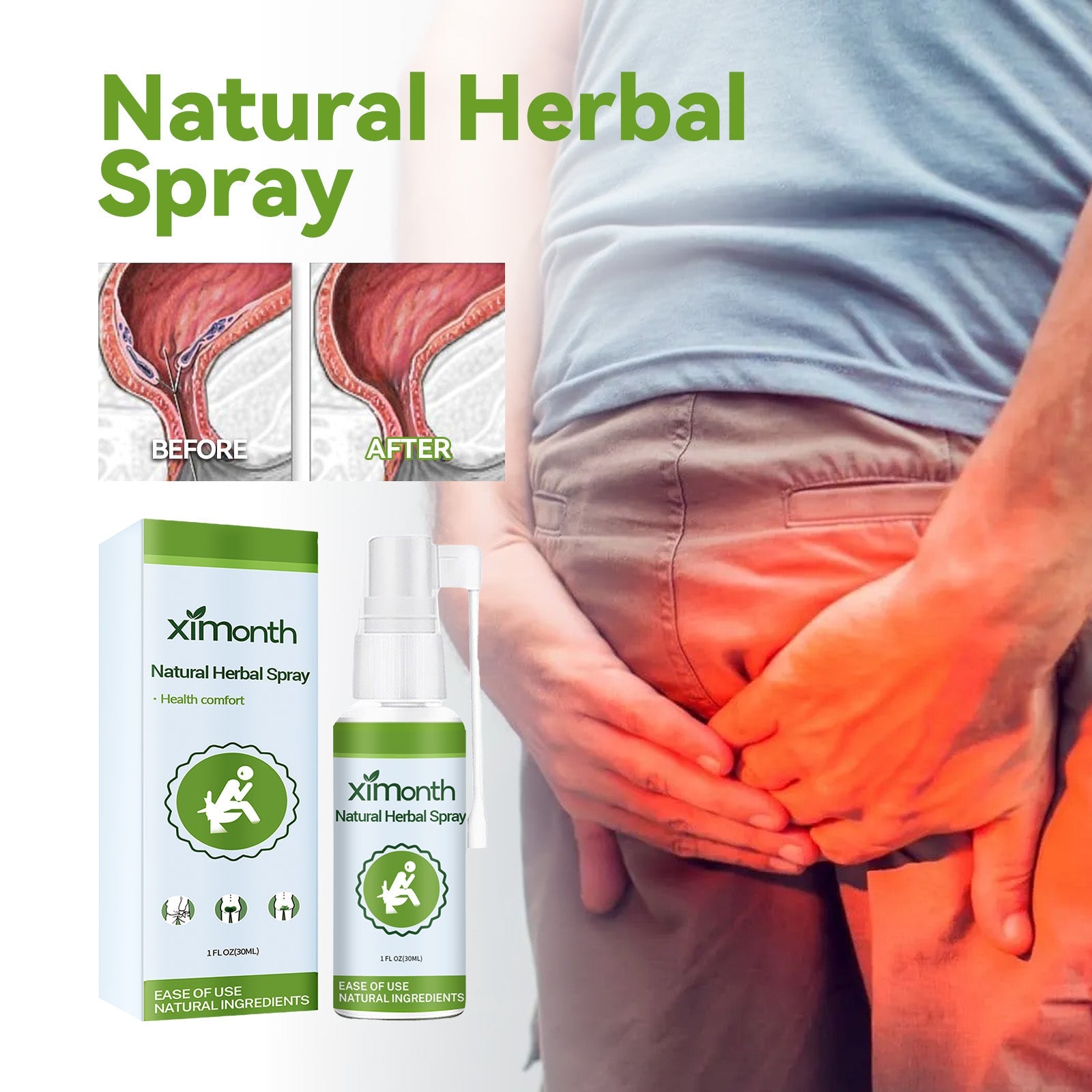 Natural Herbal Hemorrhoid Spray, Soothing Perianal Itchiness And Soothing Anal Care Spray - Korvel