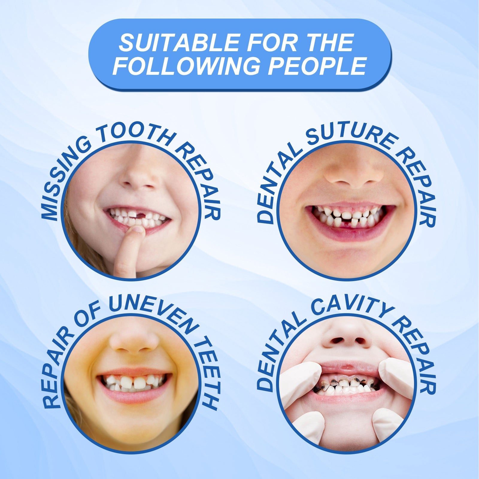 Solid Dental Glue Modification Teeth Temporary Filling Holes Filling Glue Prosthetic Dental Glue - Korvel