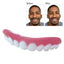 Veneers Sourire Parfait pour un Look Confiant