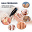 Nail Care Spray for Strengthening and Moisturizing