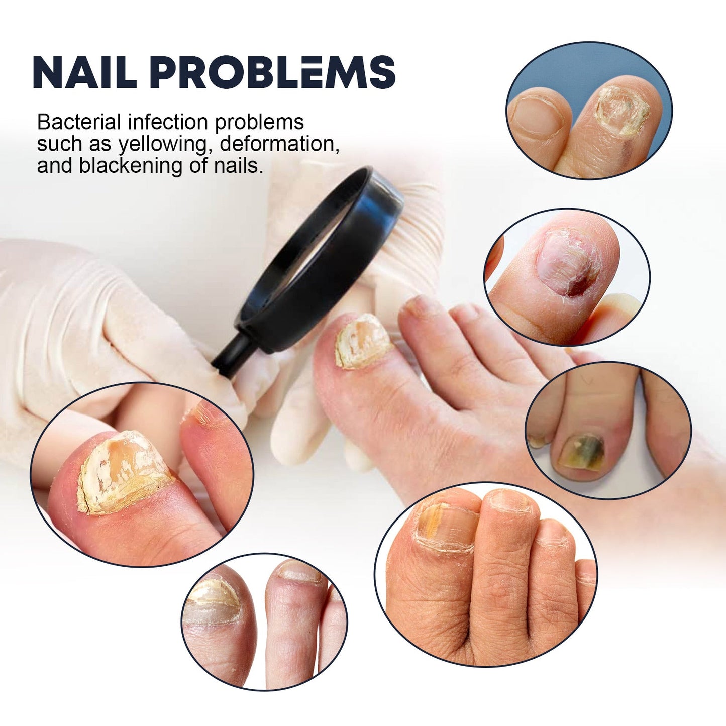 Nail Care Spray for Strengthening and Moisturizing
