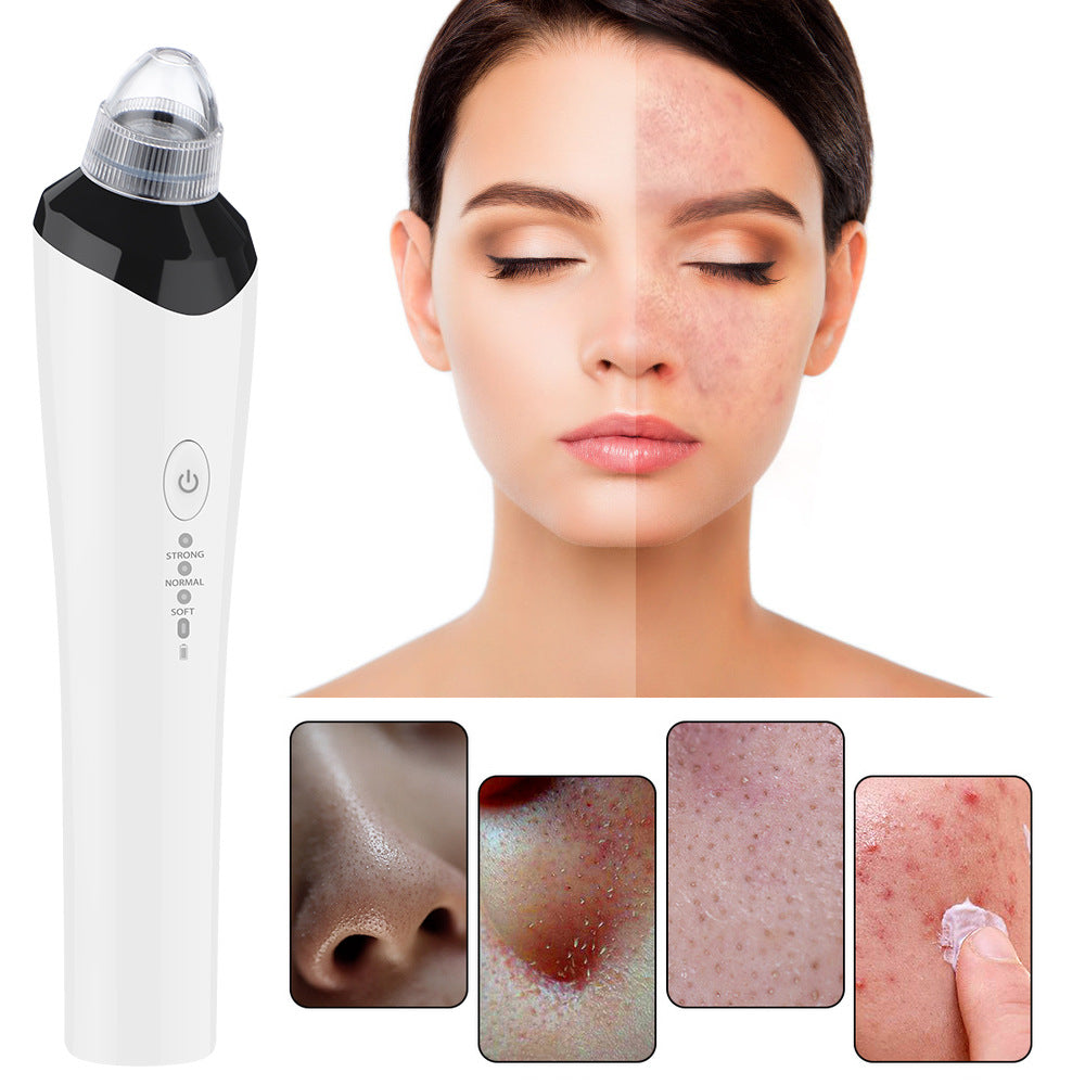 High-Definition Visual Blackhead Meter Three-Speed Intelligent Vacuum Adsorption Pore Cleaner Wifi Timing - Korvel