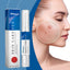 Acne Care Pen, Gently Clean Acne And Acne Closing Skin Daily Care Solution - Korvel