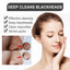 Blackhead Cleansing Cream Skin Oil Blackheads Acne Exfoliating Cleansing Repair Pore Tearing Nose Patch - Korvel