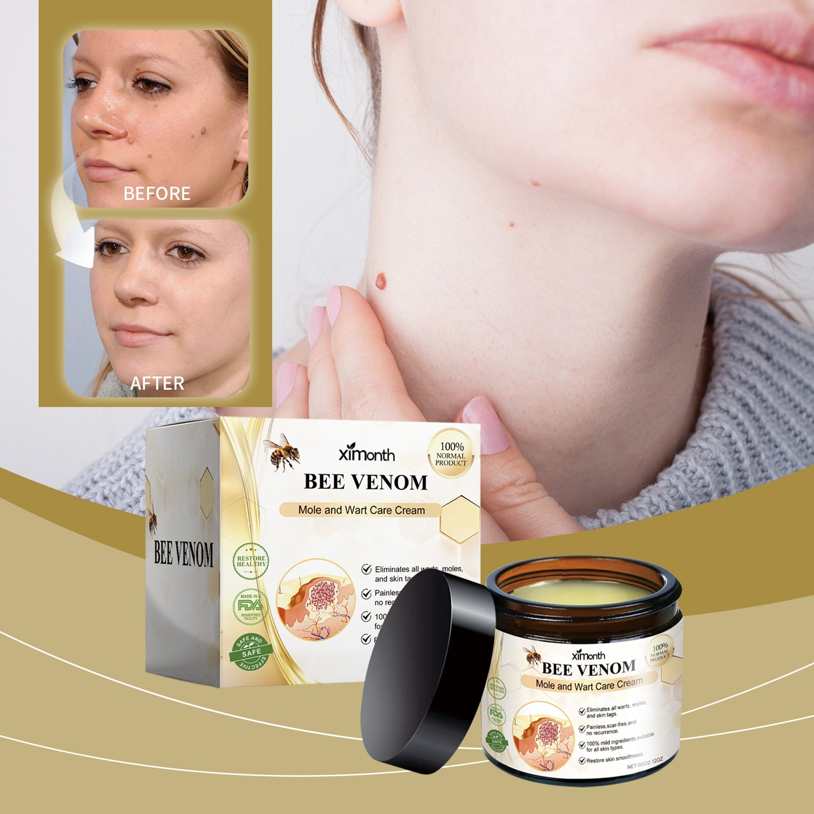 Mole And Wart Care Cream, Soft And Smooth Skin Moisturizing And Repairing Skin Care Cream - Korvel