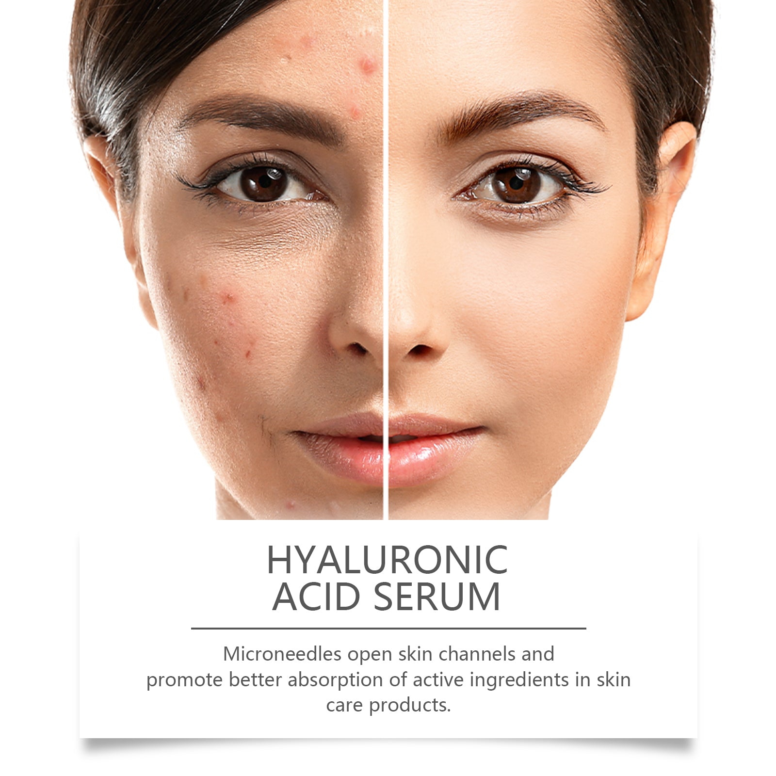 Hyaluronic Acid Face Serum, Radiant Facial Skin Improves Skin Pores And Hydrates - Korvel