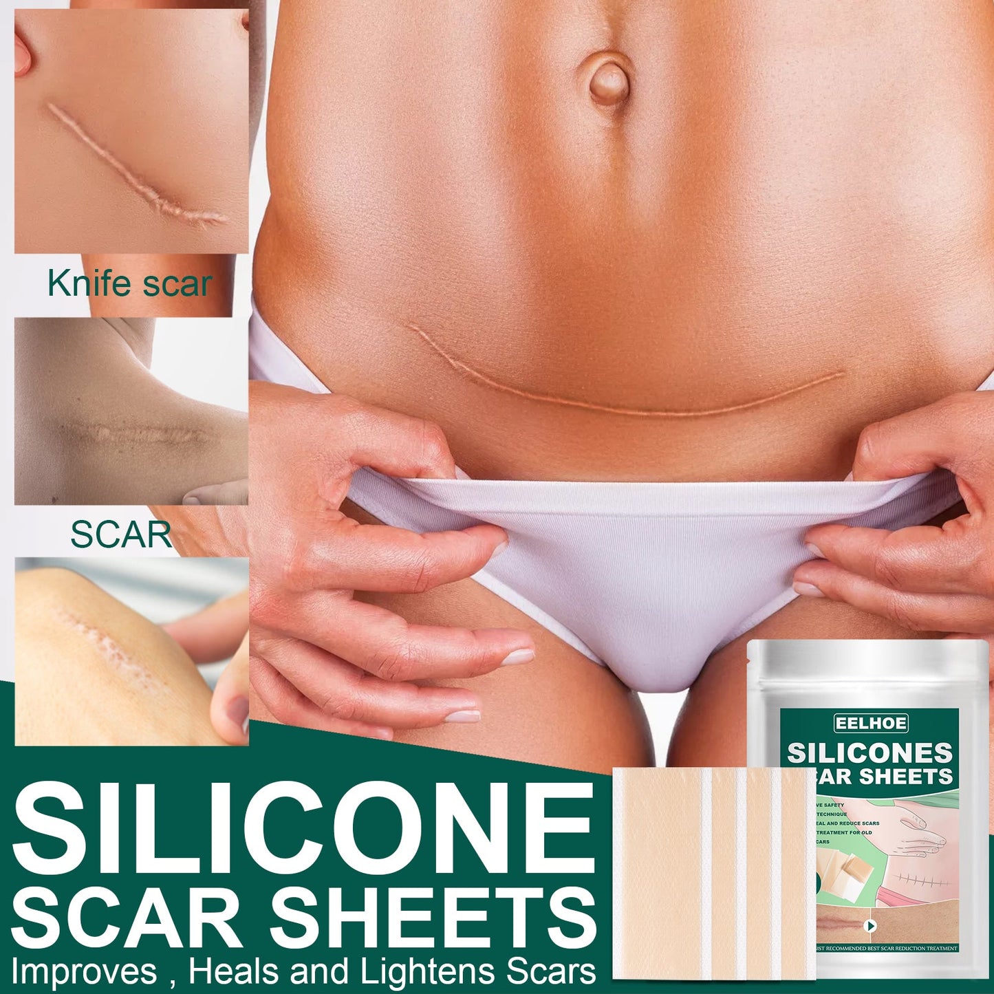 Silicone Gel Repair Patch, Fade Marks Transparent Care Skin Repair Patch - Korvel