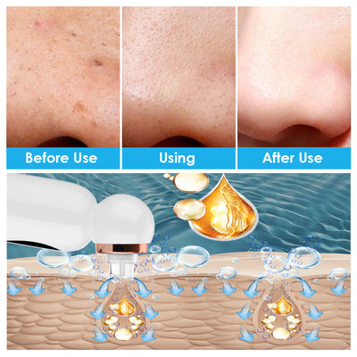 New Hailicare Small Bubble Suction Blackhead Instrument Skin Pore Cleaner Water Oxygen Circulation Skin Cleaning Instrument - Korvel