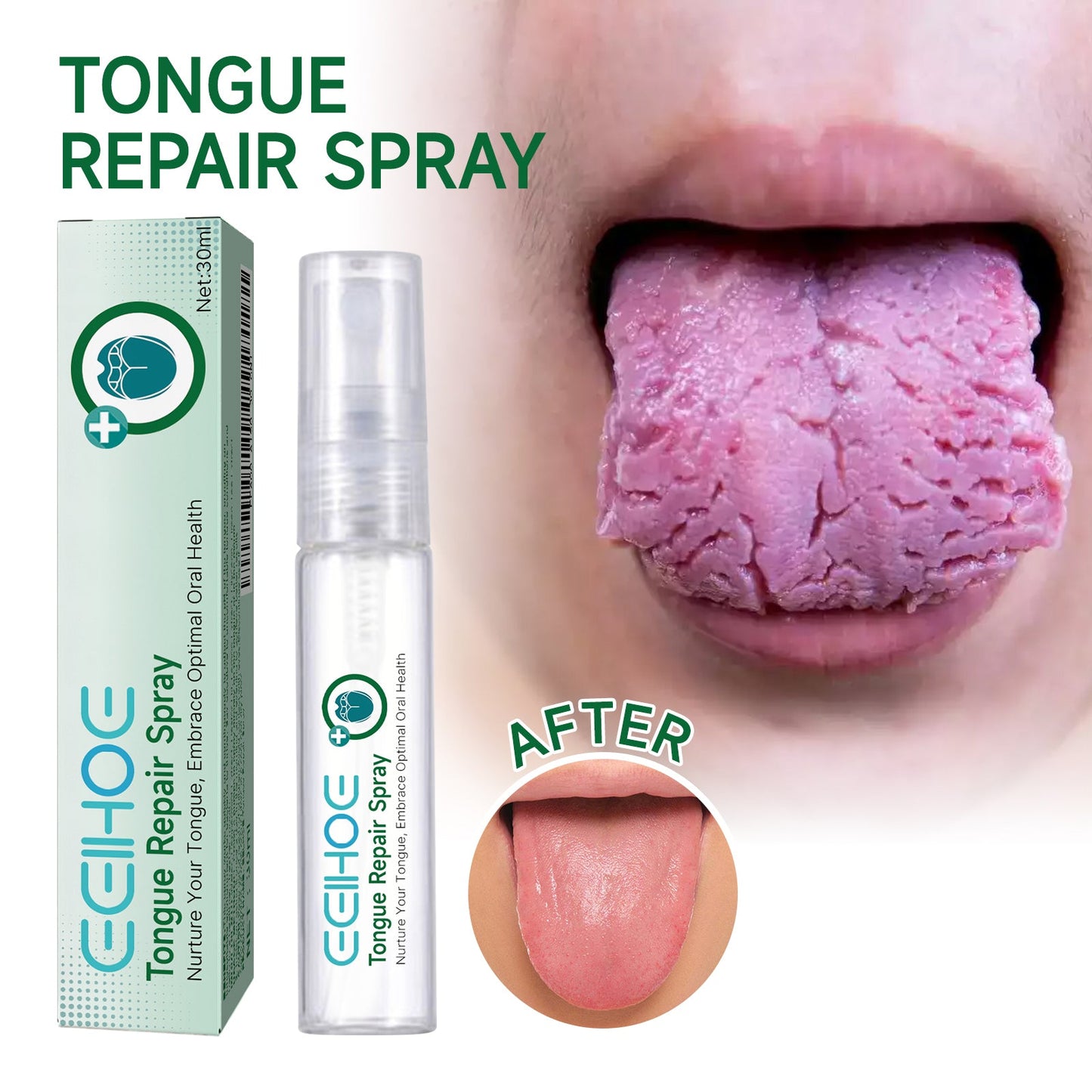 Spray Réparateur de Langue Premium pour Soin Oral