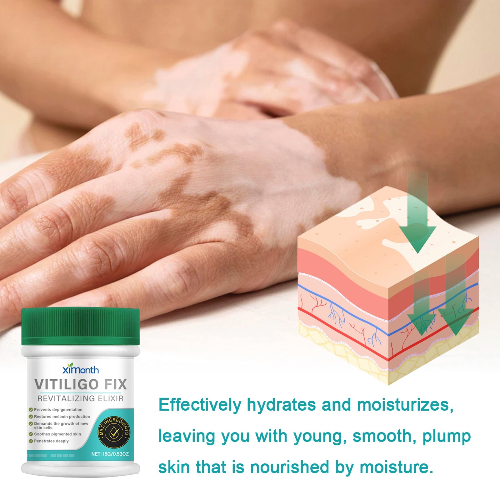 Vitiligo Fix Revitalizing Elixir, Lighten Skin Spots Even Skin Tone Moisturizing Body Care Repair Cream - Korvel