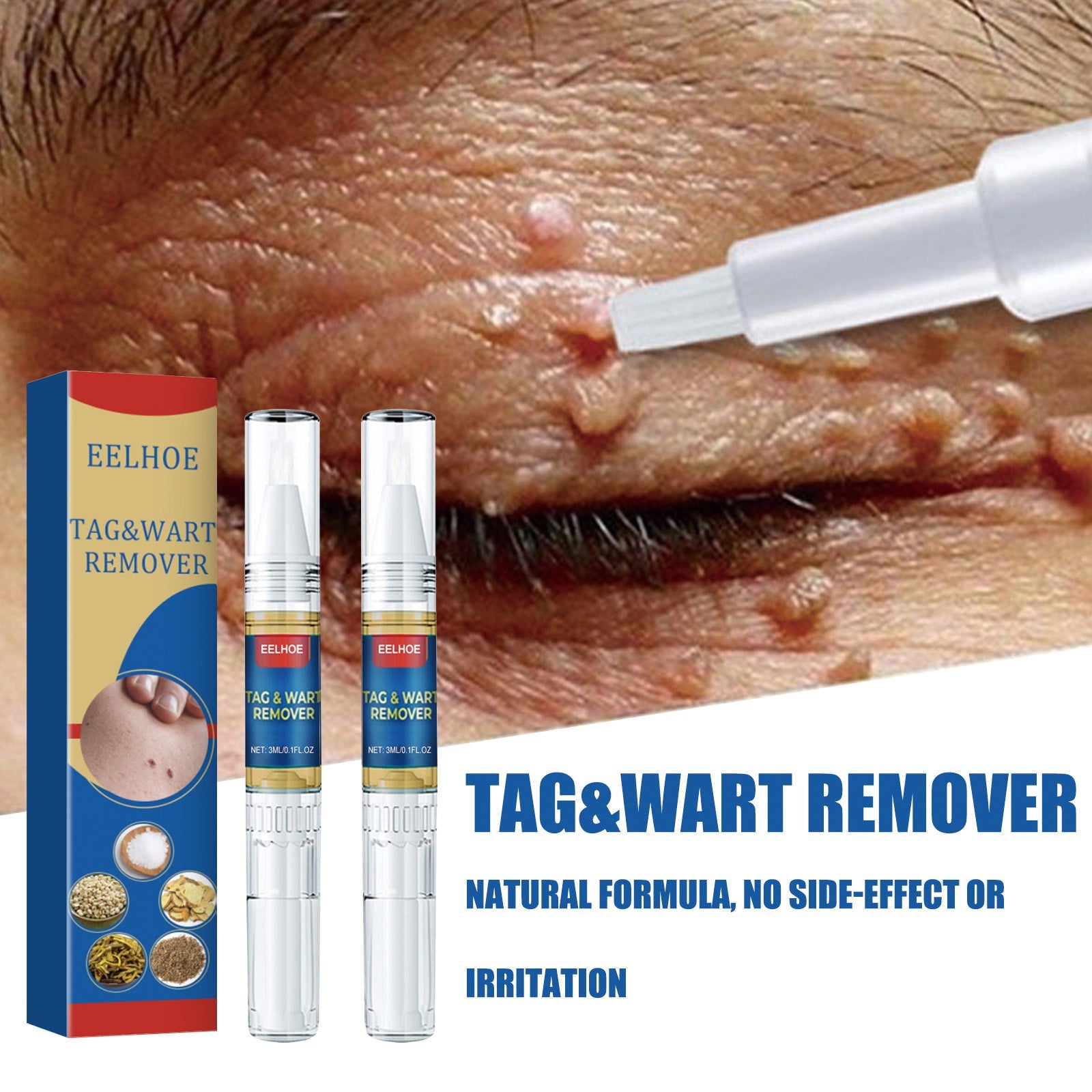 Skin Kayo Pen Gentle Body Tag Remover Cleansing Skin Care Pen - Korvel