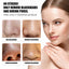 Strawberry Peel Nose Mask for Blackhead Removal