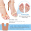 U-Shaped Felt Anti-Abrasion Pad for Foot Comfort