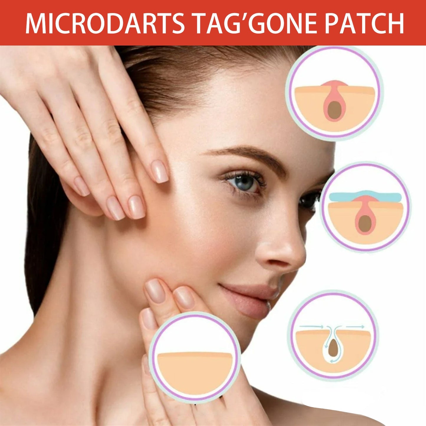 Acne Patch, Skin Clean Acne Pimple Moles Gram Wart Corns Spot Patch - Korvel