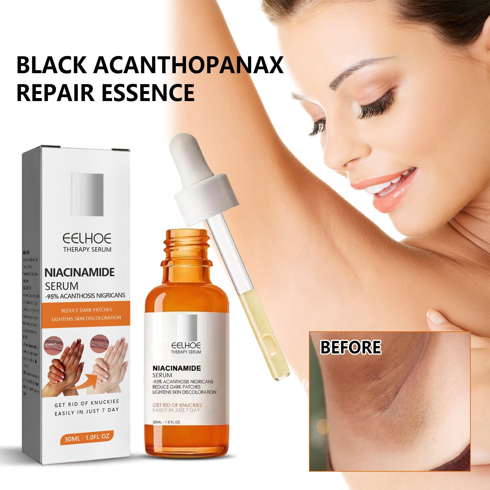 Acanthosis Nigricans Repair Essence, Brightening Skin Repair Skin Beauty Essence Underarm Joint Black Whitening - Korvel