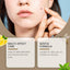 Bee Venom Removal Mole Care Cream - Korvel