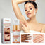 Acantho Clear Improve Skin Spray, Repair Black Spot, Elbow Knee Joint Black Whitening Skin Spray - Korvel