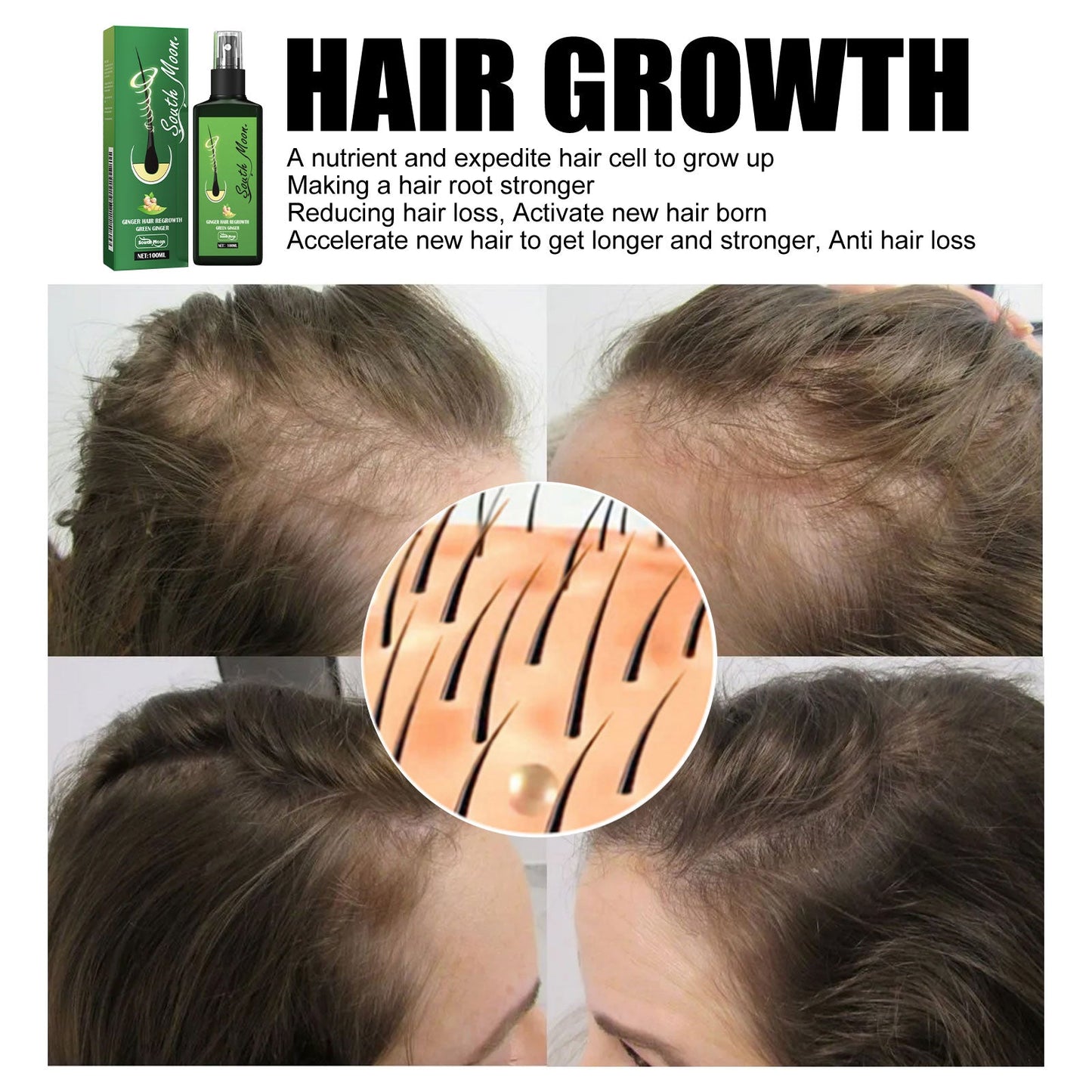 Spray Nutritivo para el Cuidado del Cabello y Reparación del Cuero Cabelludo