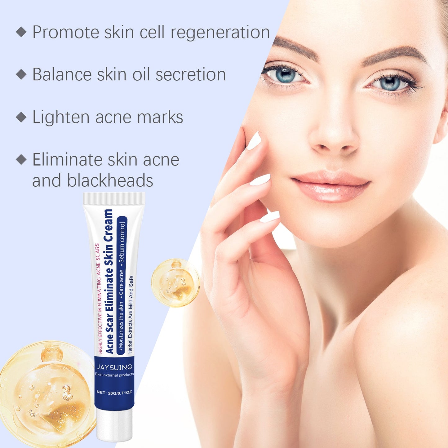 Herbal Acne-Clearing Cream Face Refreshing Oil Control Gentle Pore Cleansing Cream - Korvel