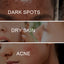 Dark Spot Whitening Cream, Lightening Yellow Brown White Spot Cream Dark Spots Correct Skin Tone Moisturize Skin Whitening - Korvel