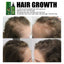 Hair Care Solution Gently Nourishes And Massages Scalp, Moisturizes And Softens Hair Care Spray - Korvel