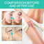 Keyu Liquid Repair Skin Pen for Smooth Skin