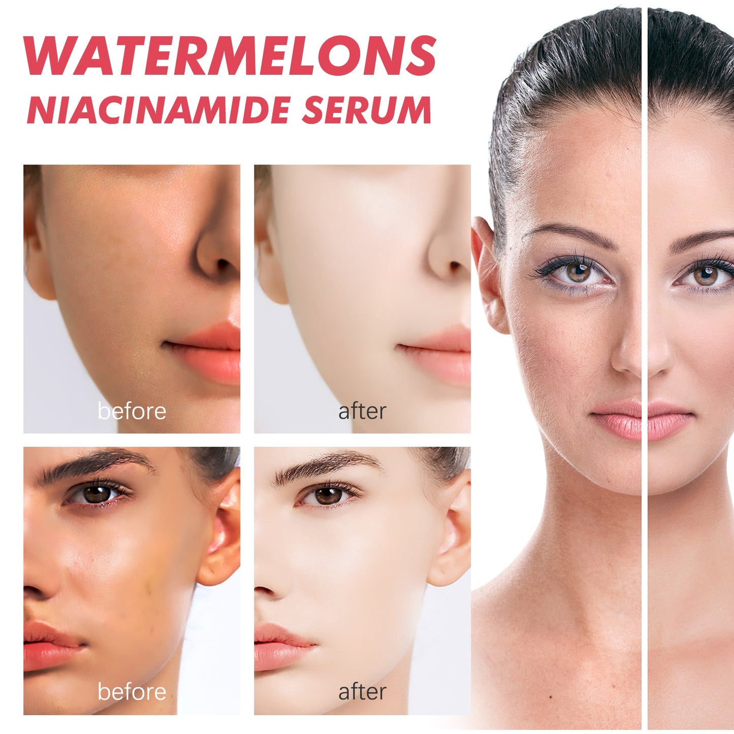 Watermelons Niacinamide Serum, Dilute Spots Firming Haun White Skin Hydrating Moisture Essence - Korvel