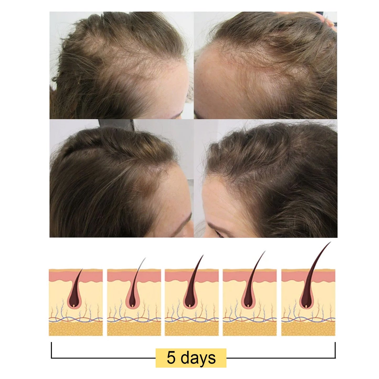 Ginger Dense Hair Soap, Moisturizes Hair Ends And Roots Cleansing Scalp Hair Care Shampoo Soap - Korvel