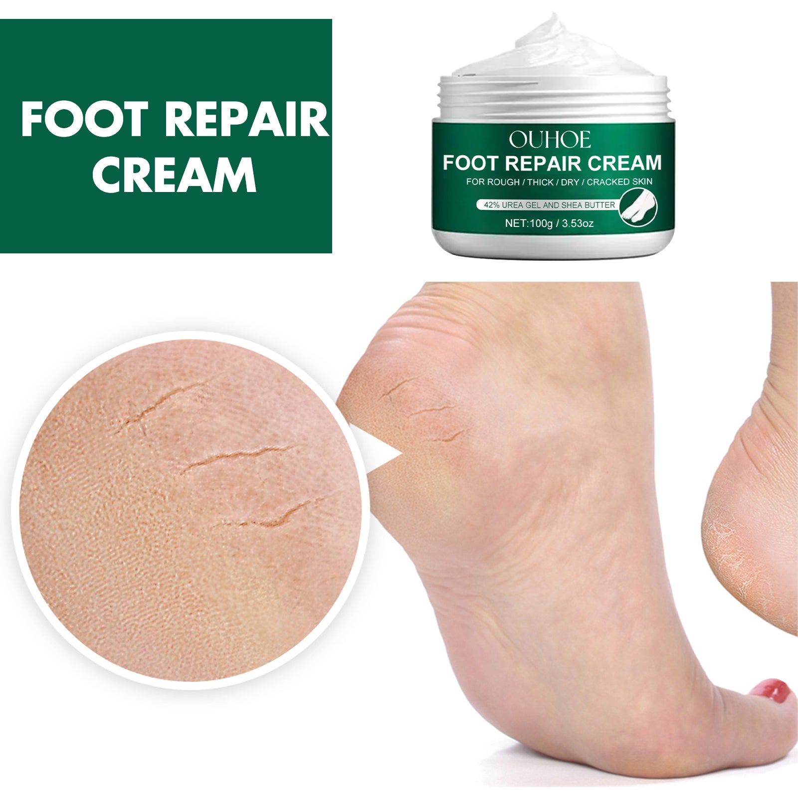 Foot Repair Cream, Repair Heel Crack Dry Itching Skin Nourishing Moisturizing Moisturizing Foot Care Cream - Korvel