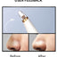 Blackhead Remover Face Deep Pore Cleaner Removal Vacuum Suction Facial SPA Diamond Beauty Care Tool Skin Care - Korvel