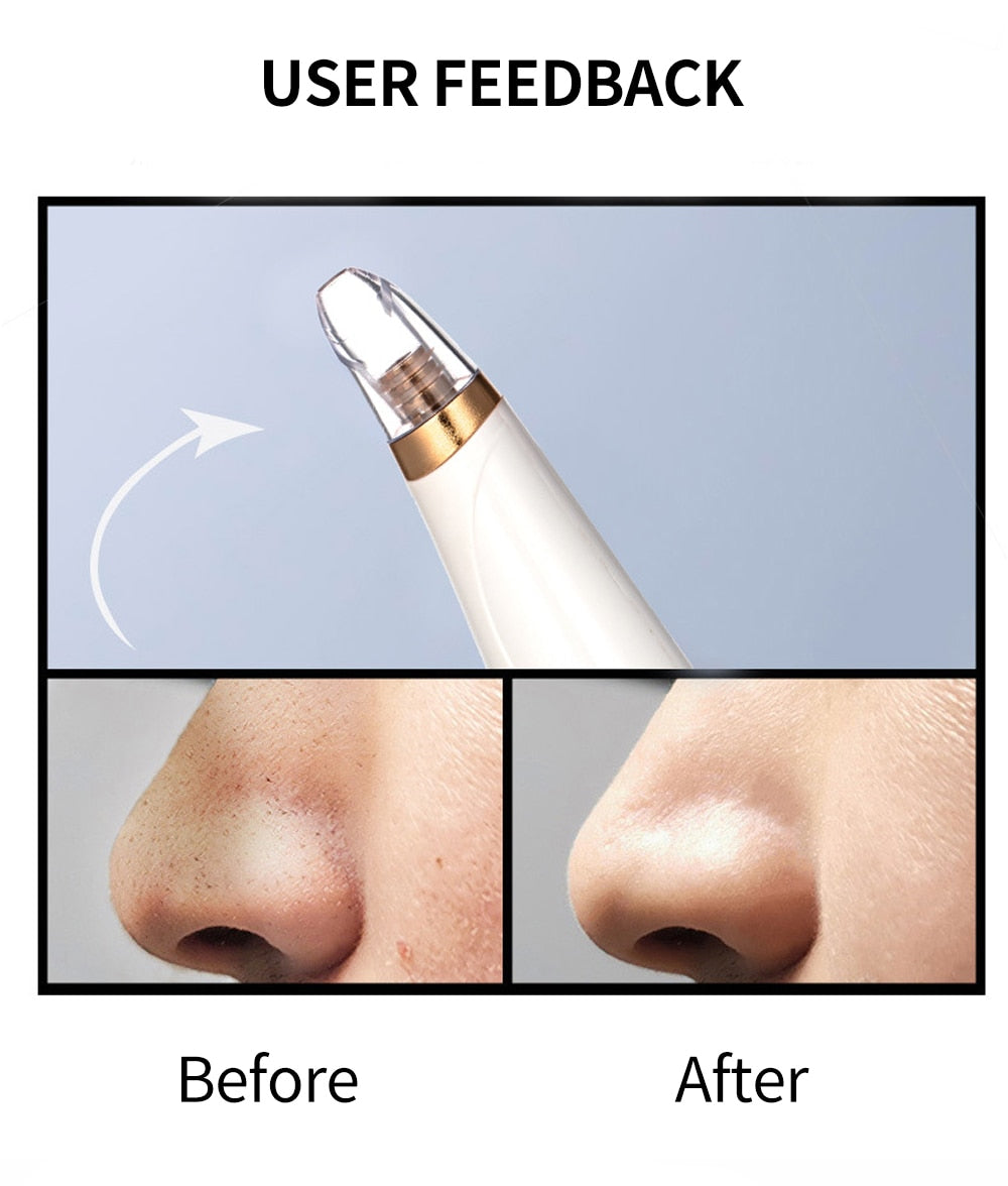 Blackhead Remover Face Deep Pore Cleaner Removal Vacuum Suction Facial SPA Diamond Beauty Care Tool Skin Care - Korvel