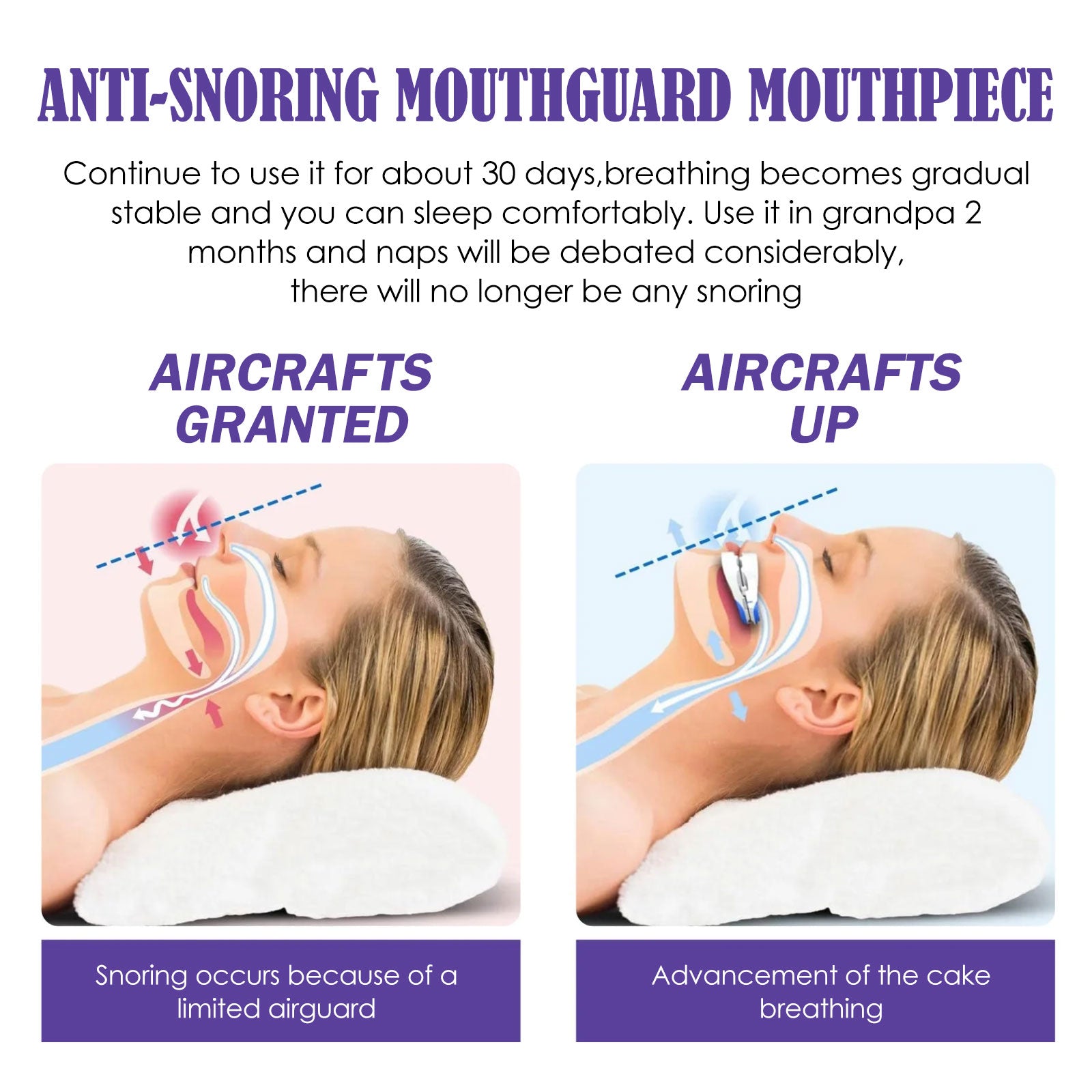 Anti-Grinding And Anti-Snoring Braces To Prevent Snoring Grinding Teeth At Night Mouthguard Protective Braces For Teeth - Korvel