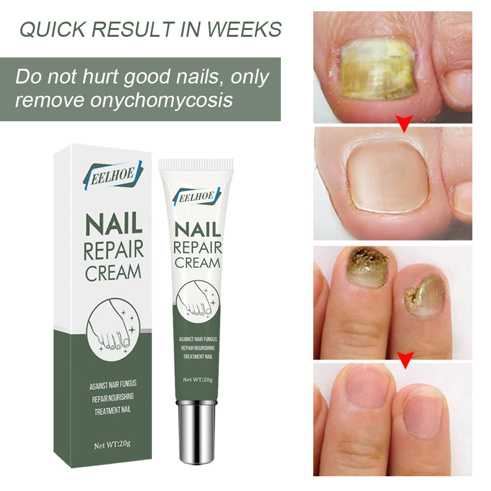 Crema Reparadora de Uñas Premium para el Cuidado de los Pies