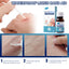 Skin Repair Patch - Waterproof and Gentle Daily Care