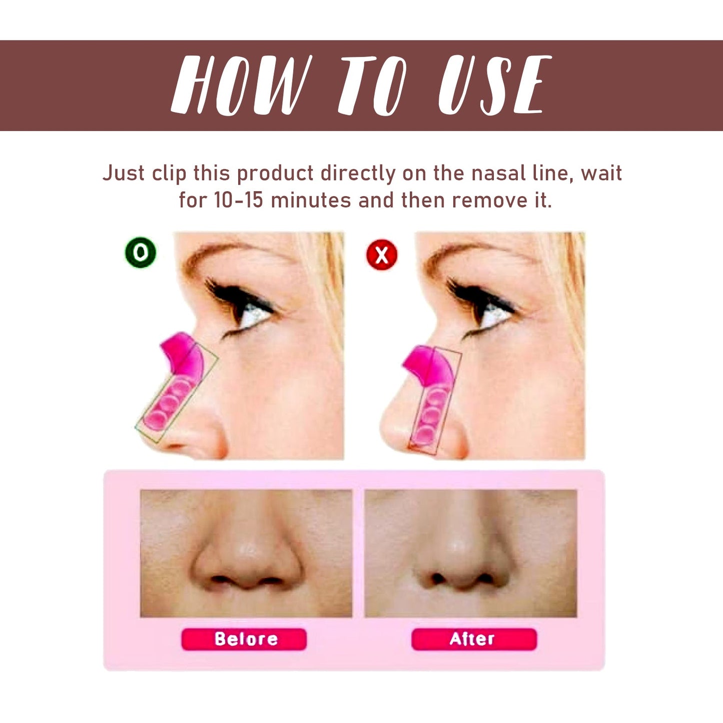Nose Straightener Nose Contour Nose Bridge Naturally Straight And Narrow Nose Wing Beauty Nose Shaper - Korvel