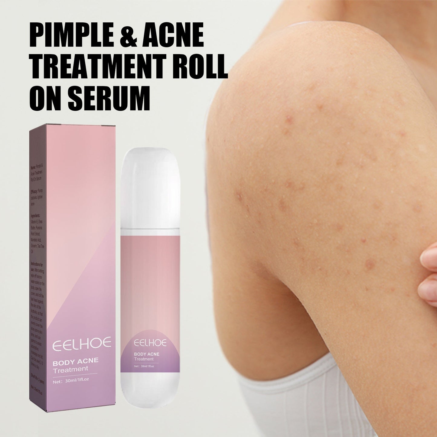 Acne Acne Ball, And Cleansing Skin Chest Back Acne Closing Skin Care - Korvel