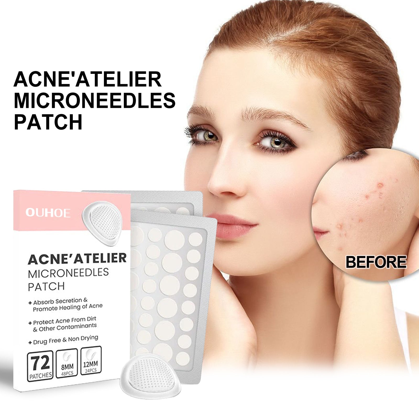 Acne Patch, Repair Acne Pimple Facial Redness Clean Pores Moisturize Skin Patch - Korvel
