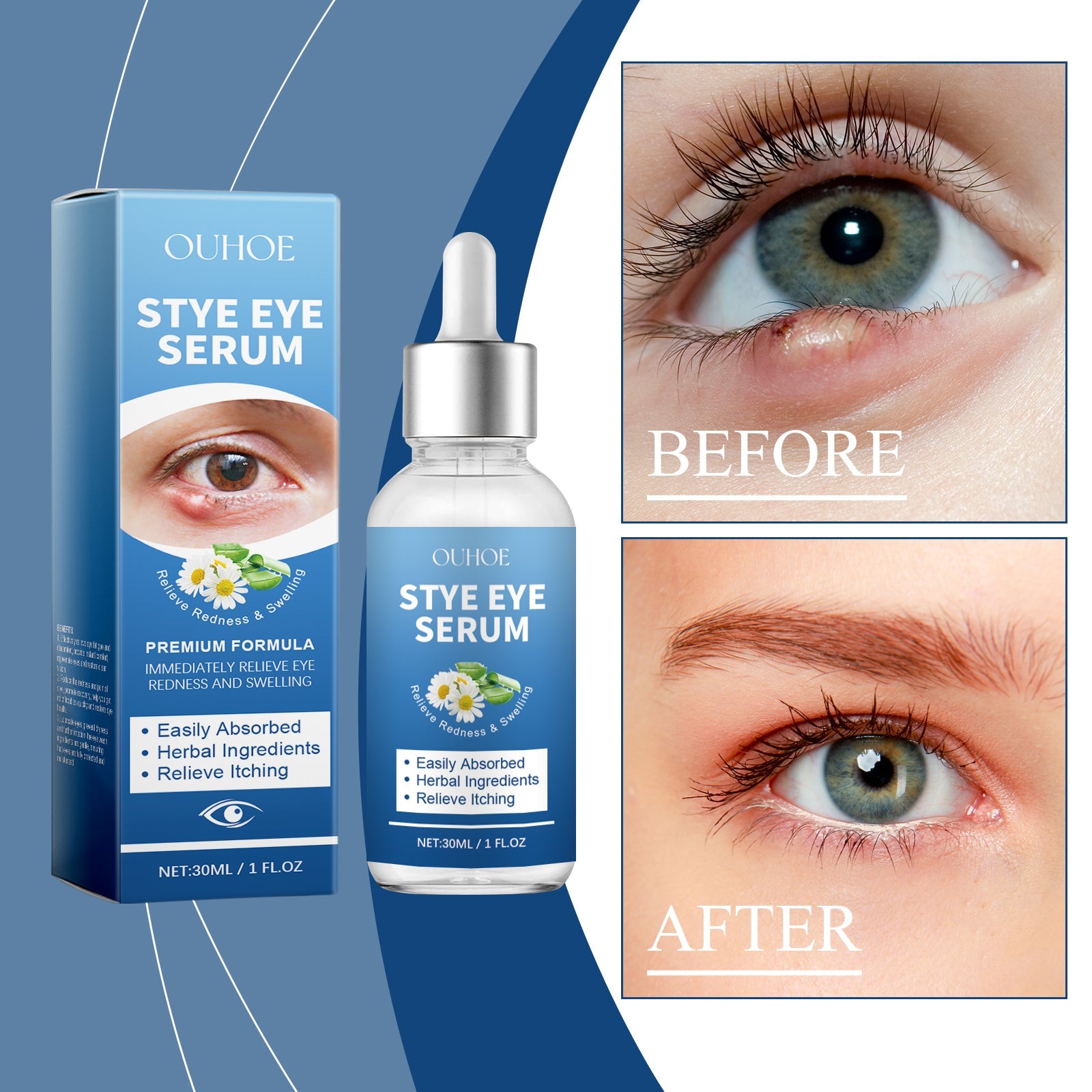 Eye Care Solution, A Gentle Moisturizing Eye Solution That Relieves Acidness, Is A Daily Portable Eye Care Drops - Korvel