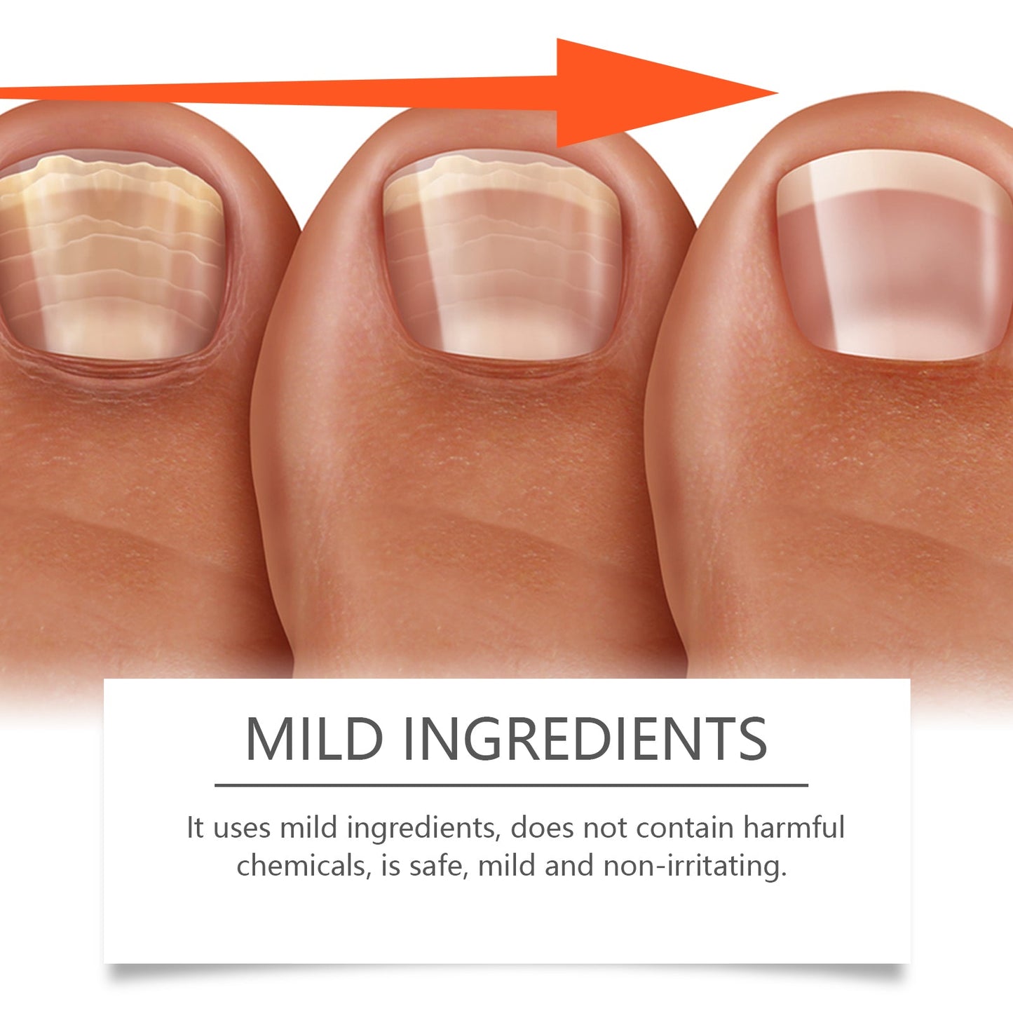 Nail Care Lotion for Cleansing and Moisturizing