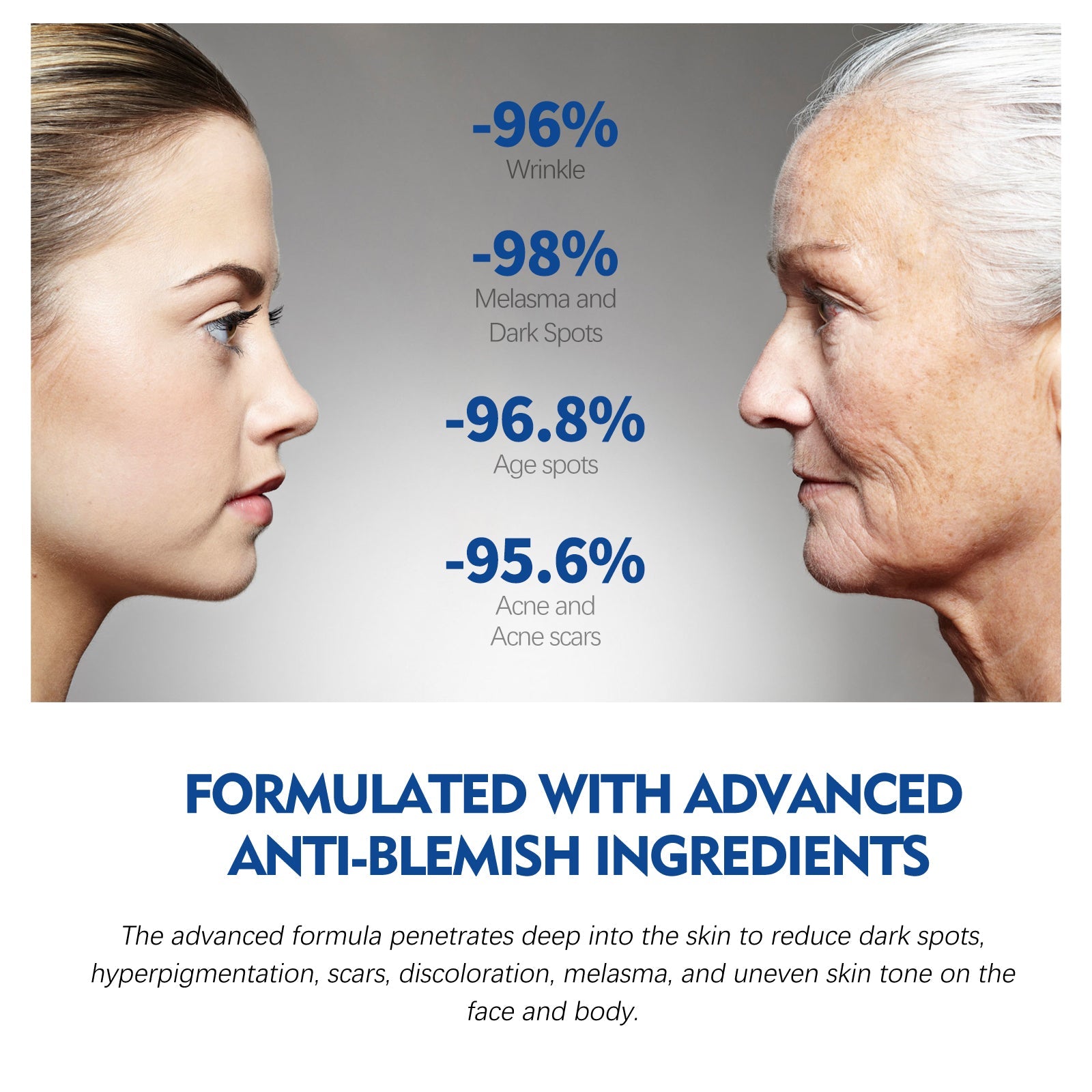 Dark Spot Repair Essence, Repair Acne Pimple Lightening Spot Fine Lines Moisturizing Firming Whitening Essence - Korvel