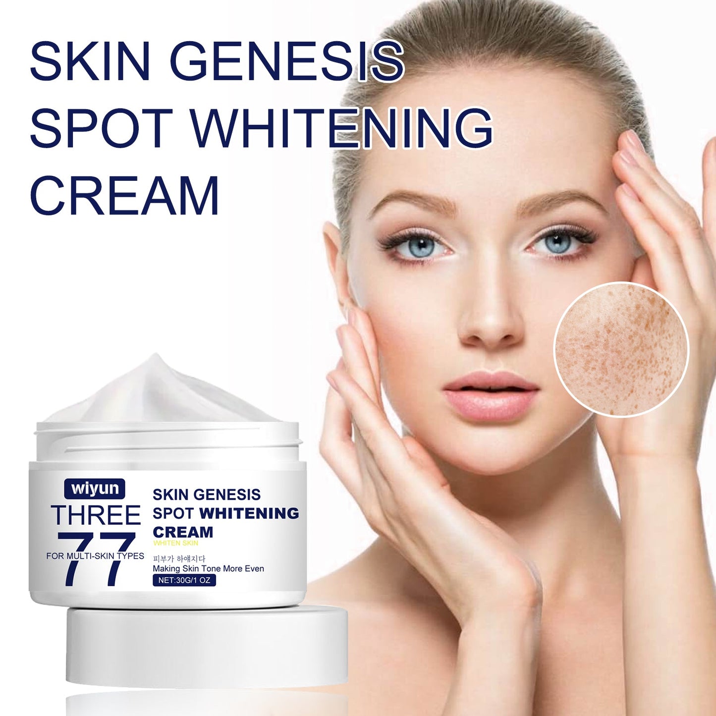 Crema Aclaradora de Manchas Skin Genesis