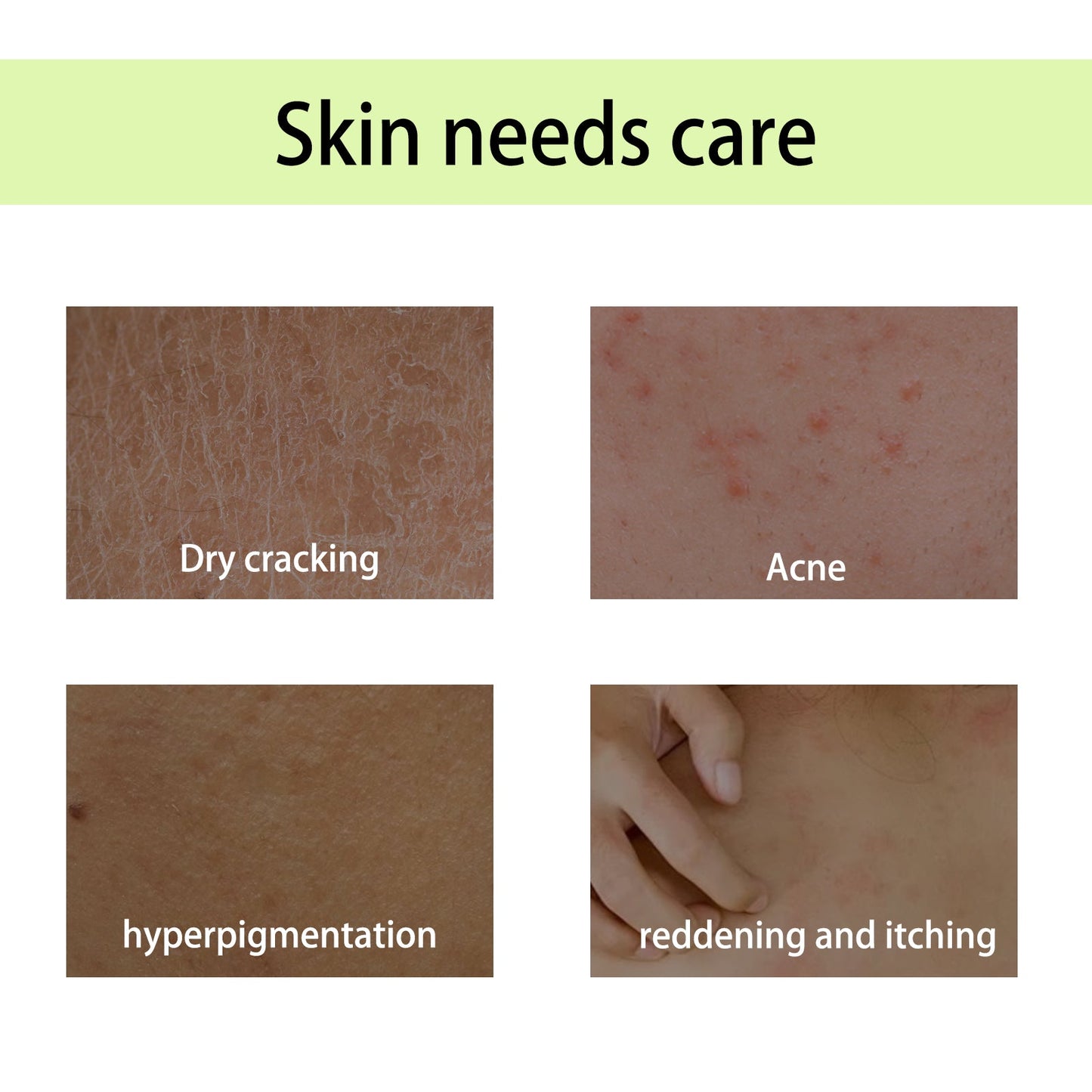 Handcrafted Body Oil, Moist Curing Firming Skin Relief Fatigue Plant Aroma Aromatic Therapy Oil - Korvel