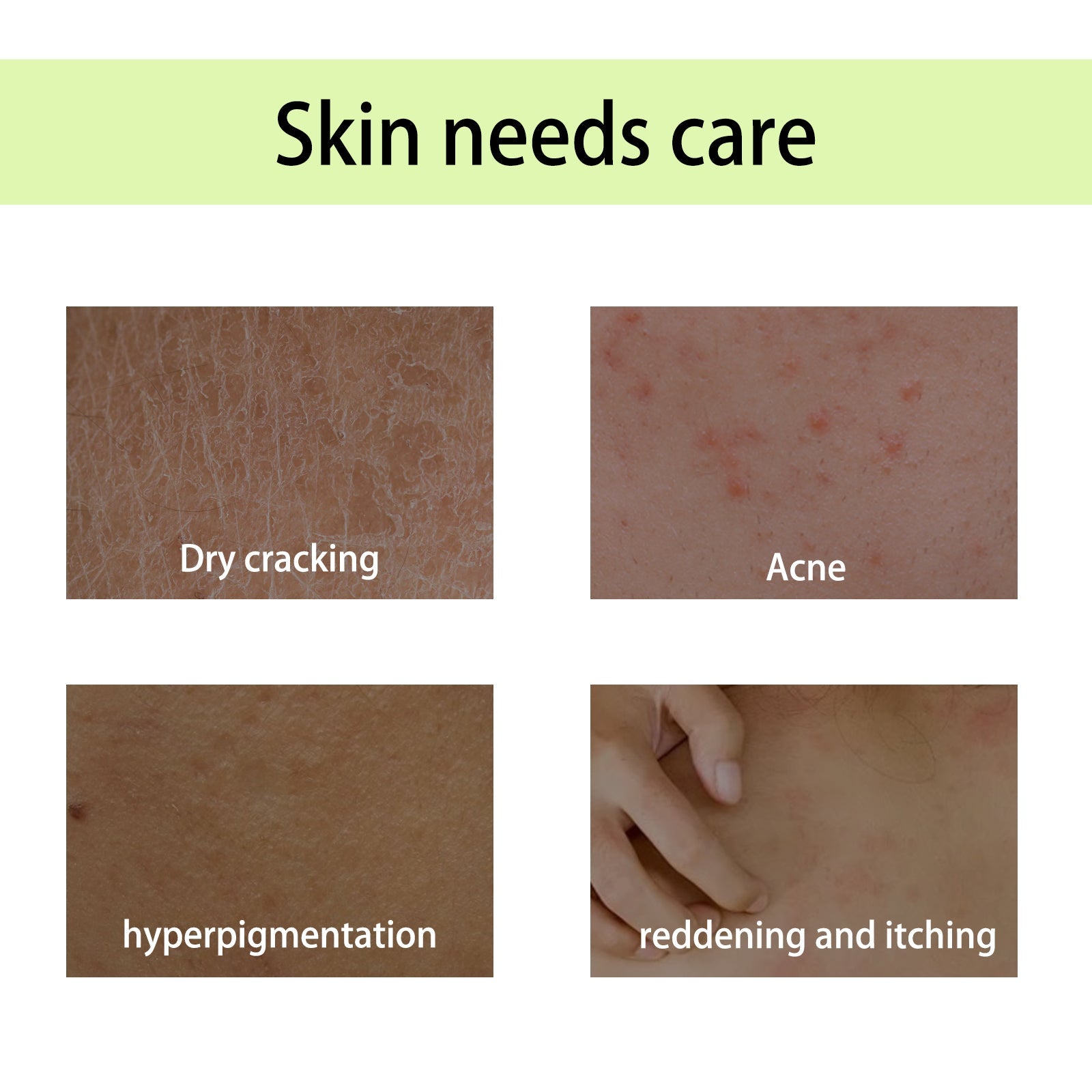 Handcrafted Body Oil, Moist Curing Firming Skin Relief Fatigue Plant Aroma Aromatic Therapy Oil - Korvel