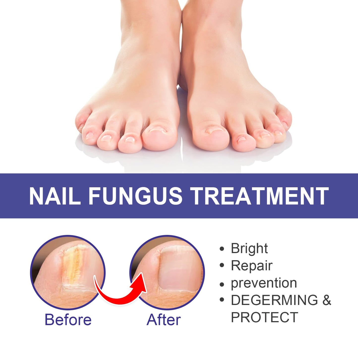 Nail Repair Lotion, Repair Thickening Nail Inlay Gray Nail Shine Soft Nail Care Solution - Korvel