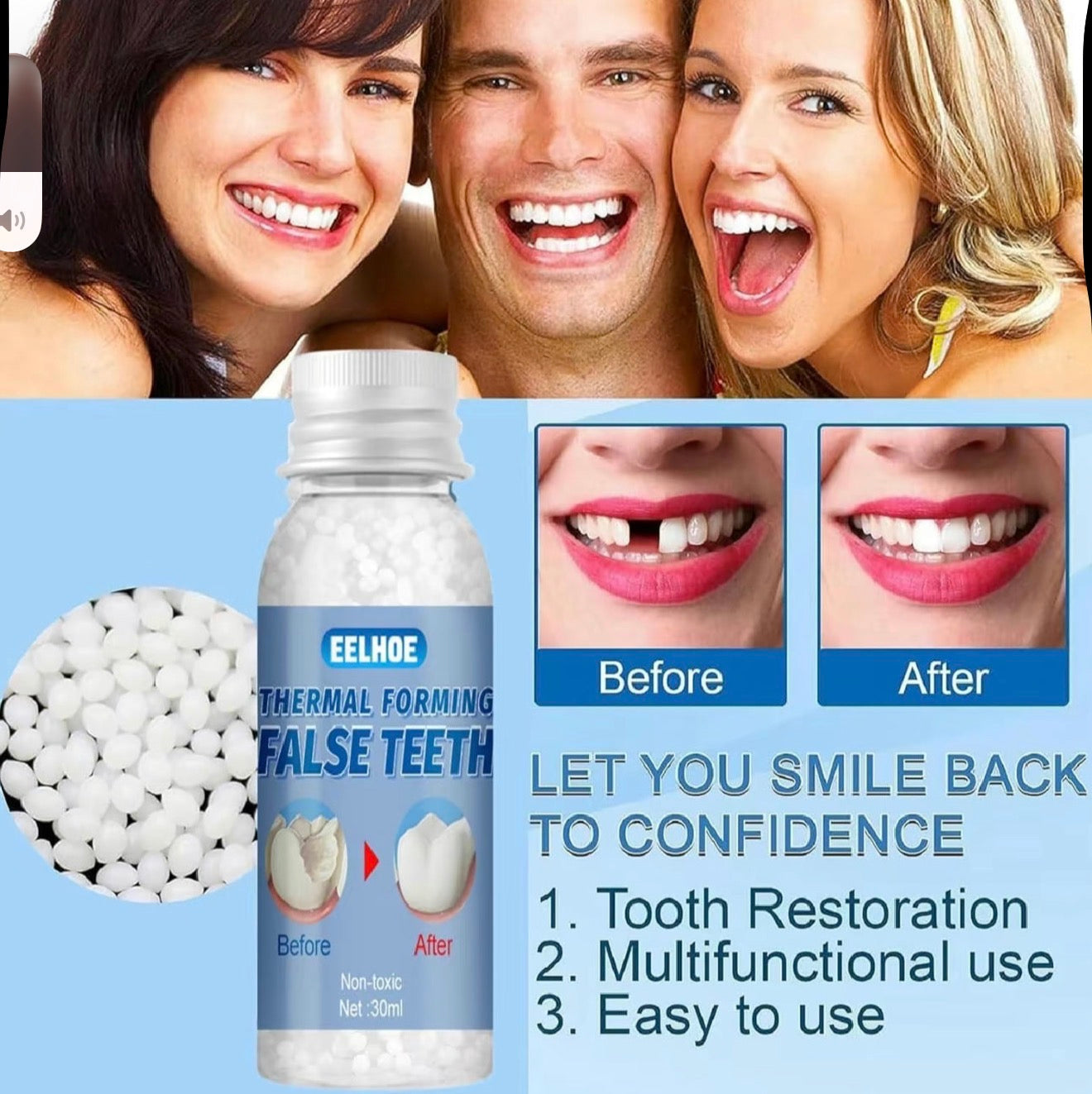 ToothMend Kit - Temporary Dental Repair Solution