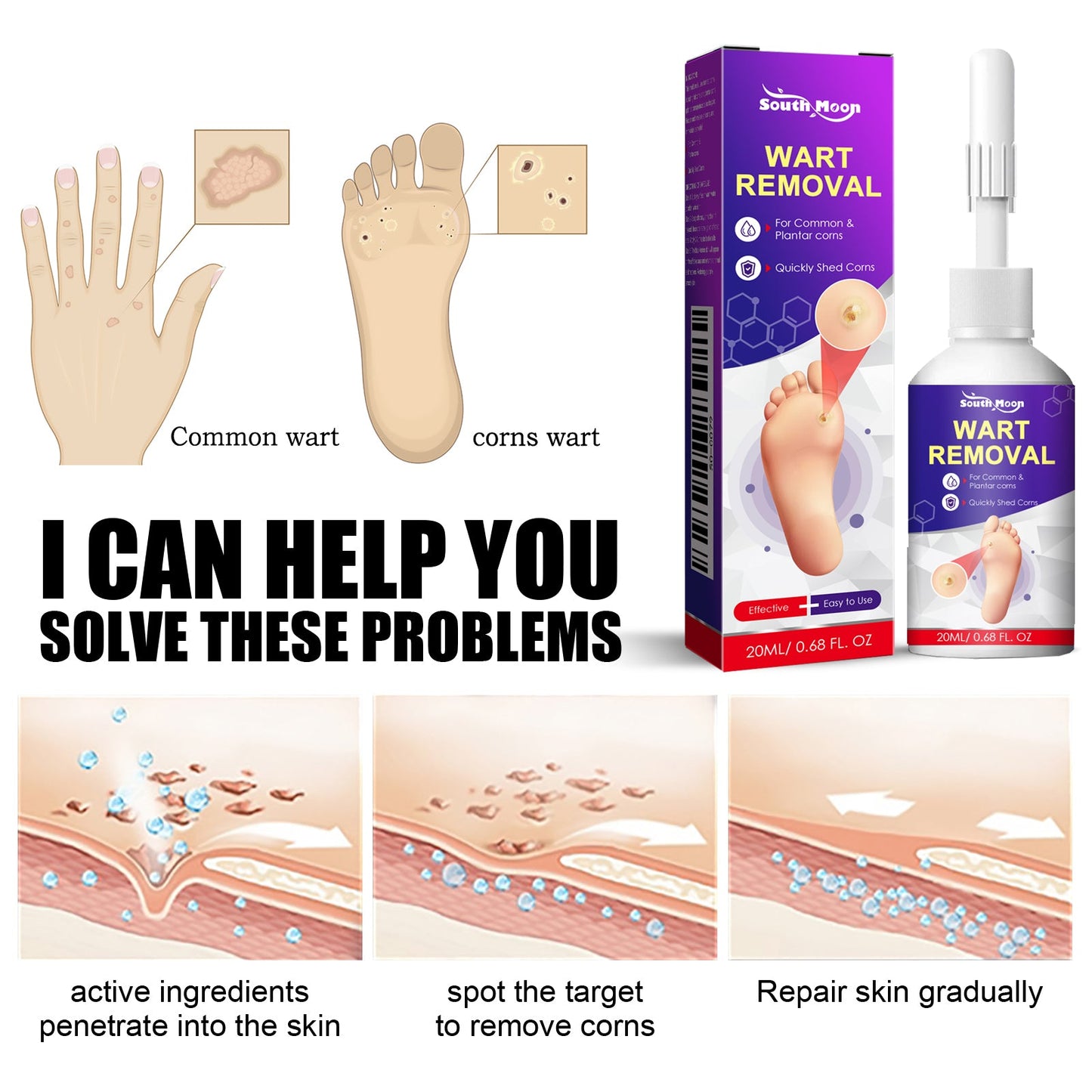 Remove Chicken Eye Lotion Extra Clear Remove Corns Skin Care Chicken Calluses Foot Pad Gram Warts - Korvel