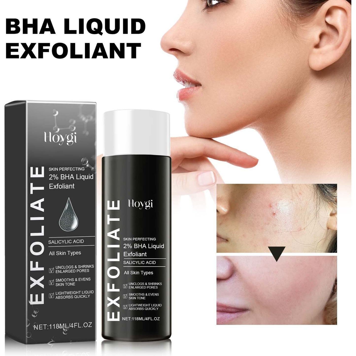BHA Liquid Exfoliant, Lightening Acne Seal Pore-Tightening And Moisturizing Skin Essence - Korvel