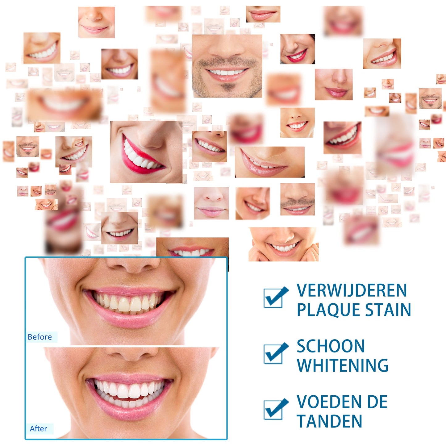 Premium Teeth Whitening Pen for Brightening Smile