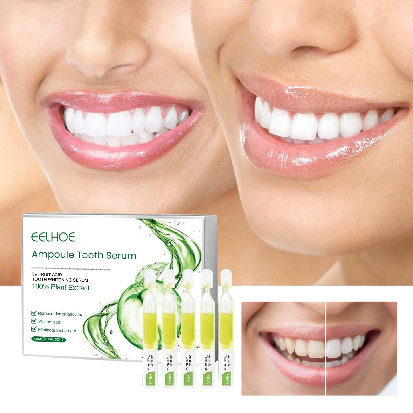 Teeth Whitening Serum To Remove Stains, Bad Breath, Whitening Teeth And Whitening Teeth - Korvel